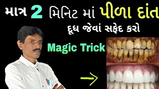 માત્ર 2 મિનીટ માં પીળા દાંત દૂધ જેવા સફેદ કરો  ManharDPatel Official [upl. by Arag126]