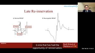 Role of Electrodiagnostic Testing in Spine Care [upl. by Nnylesor]