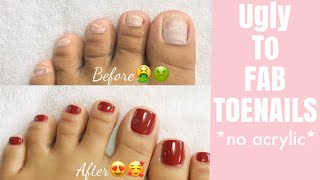 TOENAILS TRANSFORMATION 😍😱No Acrylic • EASY amp SUPER AFFORDABLE • [upl. by Cartan]