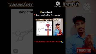 💉नशबंदीvasectomy medical procedureanatomypopularmosttrendingwowviralvideo [upl. by Rozamond695]