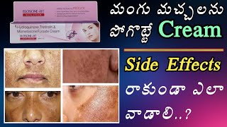 Elosone HT Cream Uses In Telugu  Pigmentation Cream  Melasma  Skin Cream [upl. by Cleary]