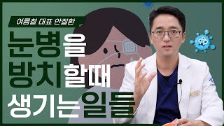 눈병에 걸렸을 때 방치한다면 여름철 눈병을 방치하면 안되는 이유 [upl. by Harelda767]