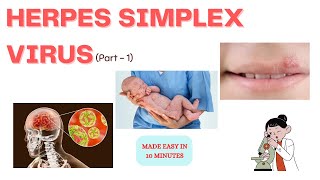 Herpes simplex virus  Part  1 In just 10 minutes  Medinare [upl. by Marabel322]