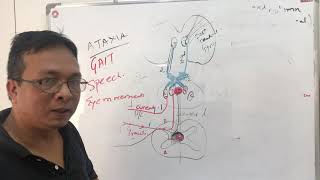 DCMLdorsal column medial lemniscalRhombergs testposterior cord syndromeFriedrichs Ataxia [upl. by Ayikan]