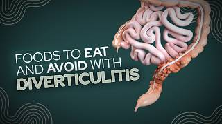 Foods To Eat and Avoid With Diverticulitis [upl. by Pope]