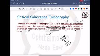 Introduction to OCT in Glaucoma doctor glaucoma eyecare [upl. by Ahgiela]