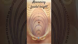 Fundal Height measurement [upl. by Trumaine]