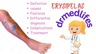 Erysipelas causes symptoms differential diagnosis complications treatment [upl. by Llener501]