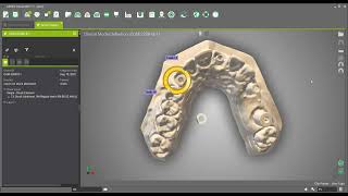 Create a full implant crown with a screw channel on a stock abutment [upl. by Westbrooke]