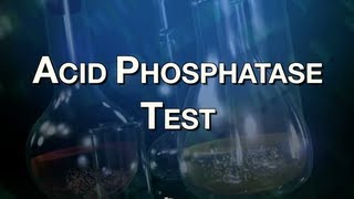 Acid Phosphatase Test [upl. by Blanchette586]