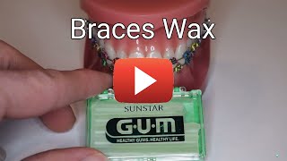 Braces Wax [upl. by Ibok]