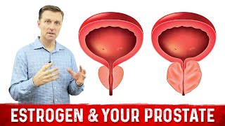 How To Fix Enlarged Prostate Explained By Dr Berg [upl. by Yrrol811]