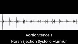 Aortic Stenosis Ejection Systolic Murmur [upl. by Egedan]