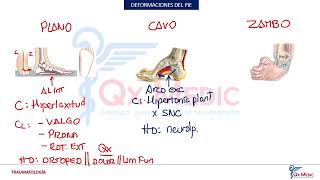 Traumatología  Deformaciones del pie [upl. by Gianna356]