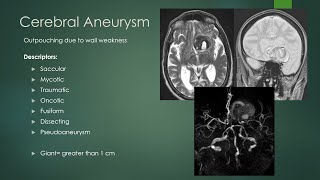 Intracranial aneurysms  NEW  fixed pointer [upl. by Cristy735]