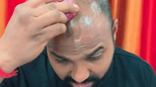 how to use adivashi hairoil original part2 आदिवासी oil adivasi hair oil original viral jhansi [upl. by Ocicnarf]