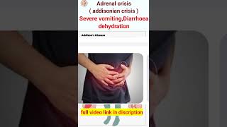 Adrenal crisis symptoms  Addisonian crisis  symptoms shorts shortsfeed nursingveda [upl. by Yolanda]