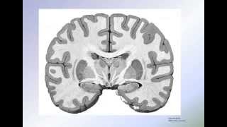 Histologie du neocortex [upl. by Ahtiek832]