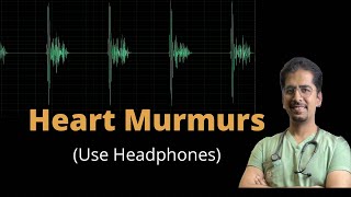 Heart Murmurs in just 20 mins use Headphones [upl. by Whetstone904]