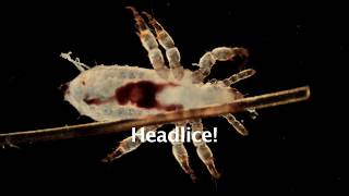 Head Lice Microscopic View [upl. by Silloc798]