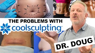 The True Cost of COOLSCULPTING 😱 Body Modification DISASTERS [upl. by Remington419]