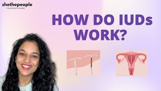 What you should know before getting an IUD  Answers Dr Theertha Shetty [upl. by Ahseeyt]