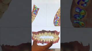 Can I Wear Invisalign Only At Night [upl. by Vance]