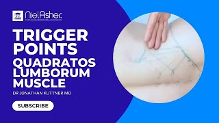 Trigger Point Release  Quadratus Lumborum [upl. by Anail933]