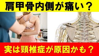 肩甲骨の内側が痛い？実は頸椎症が原因かも！驚きのメカニズムと対策を徹底解説 [upl. by Blancha755]