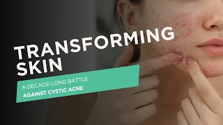 Transforming Skin  A DecadeLong Battle Against Cystic Acne [upl. by Atirehs661]