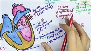 Tetralogy of Fallot TOF [upl. by Lambertson869]