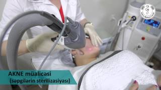 AKNE müalicəsi səpgilərin sterilizasiyası [upl. by Sergius]