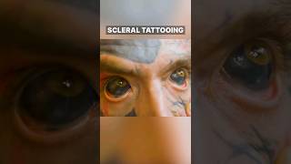 Eyeball Tattoo Scleral Tattoo [upl. by Ydnir457]