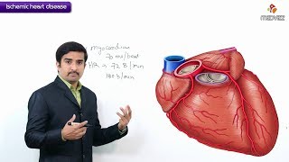 Ischemic Heart Disease  Coronary heart disease  Usmle step 1  Definition and Coronary blood flow [upl. by Noitna]