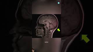 MRI Machine amazingfacts interestingfacts factsinhindi knowledge shorts [upl. by Nhguavad849]