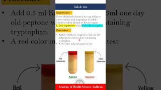 Indole test  Microbiology  by ImranYaseen [upl. by Sontich795]