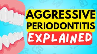 AGGRESSIVE PERIODONTITIS EXPLAINED IN 5 MINUTES  CAUSE DIAGNOSIS RISK FACTORS AND TREATMENT [upl. by Carol]