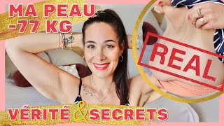 PERTE DE POIDS 77 KG  La vérité rétablie et secrets pour limiter la peau distendue [upl. by Jeanie]