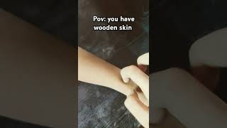 Wooden skin woodface comedy funny relatable fypシ゚viral memes [upl. by Harrod289]