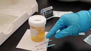 Chemistry Urine Fertility Screening Tests [upl. by Iover]