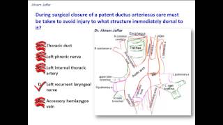 What structure is immediately dorsal to the ligamentum arteriosum [upl. by Dart]