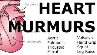 Heart Murmurs  Locations Maneuvers Buzzwords [upl. by Rip]