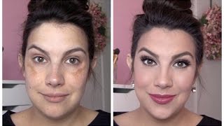 FULL COVERAGE Makeup for Melasma amp Discoloration [upl. by Tillford872]