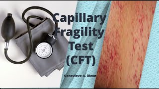 Capillary Fragility Test CFT [upl. by Otho95]