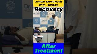 Lumbar Spondylosis with Sciatica Recovery After Treatment motivation yt yt doctor sciatica fy [upl. by Dnalhsa]