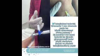 foamscleroterapy Telangiectasia teleangiectazsialeg telengiectasia telengictasiatherapy [upl. by Jerrylee320]