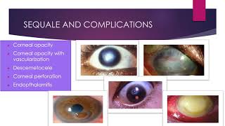 CORNEAL ULCERS [upl. by Saalocin216]