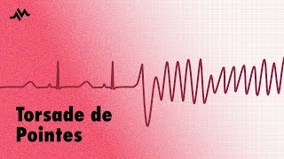 Torsade de Pointes  EKG ECG Interpretation [upl. by Leacock]