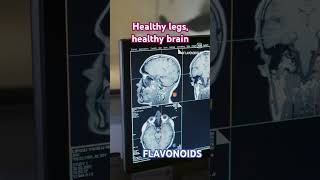 Healthy legs healthy brain blood circulation with Flavonoids legs brain [upl. by Cornelle]