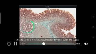 stomach cardiac and pyloric region and rugae [upl. by Burnsed]